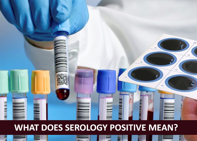 Serology | Diagnostic centre in hooghly