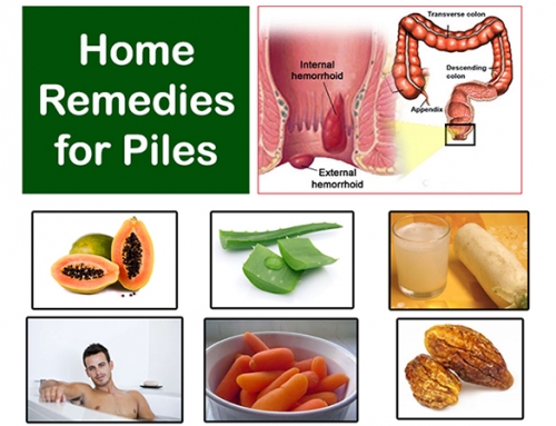 How to Cure Piles At Home Naturally