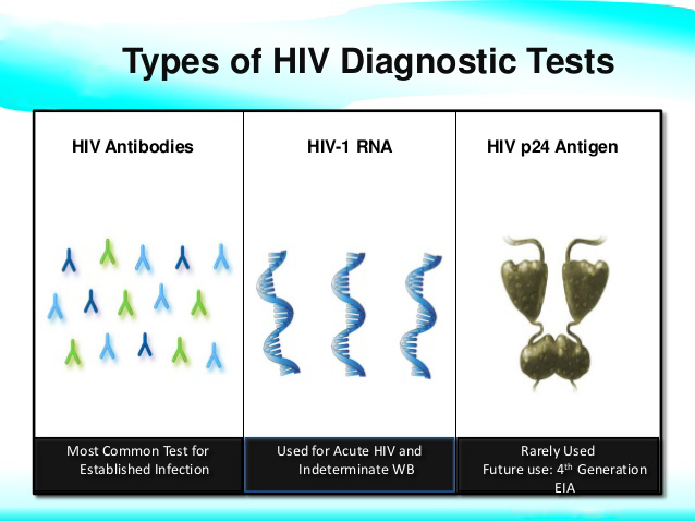 Different Tests to Diagnose HIV- pathology lab in uttarpara