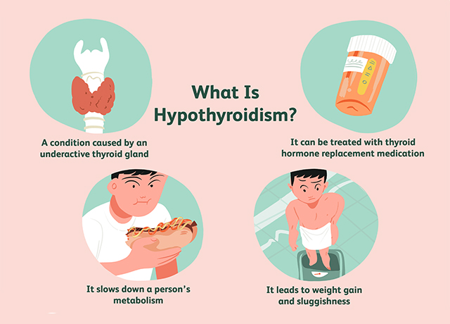 10 Signs and Symptoms of Hypothyroidism