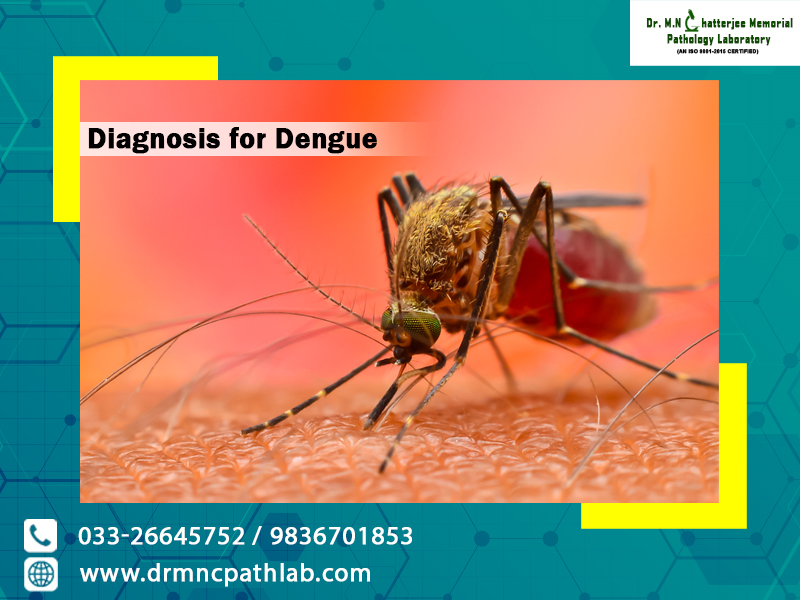 Diagnosis for Dengue