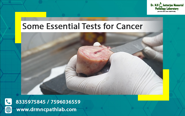 Some Essential Tests for Cancer