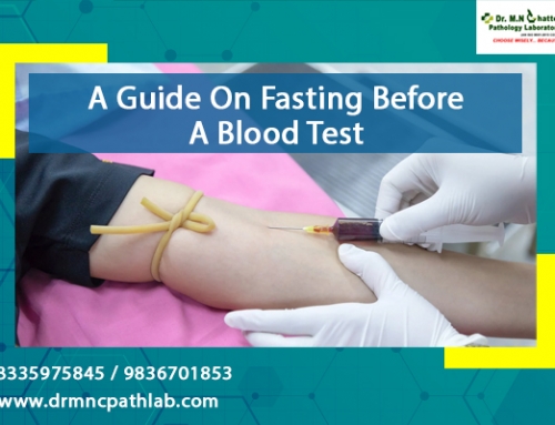 A Guide On Fasting Before A Blood Test