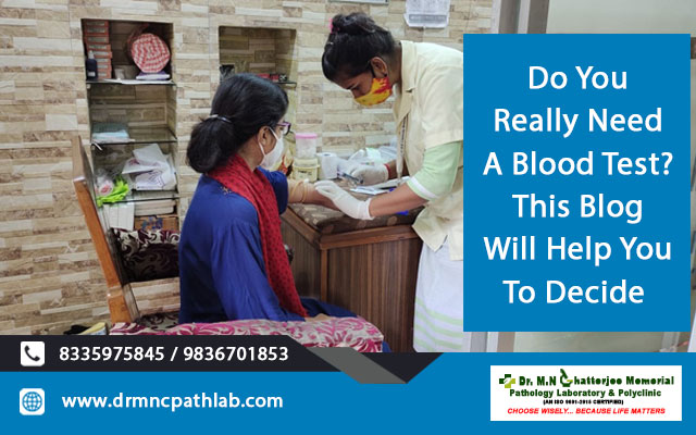 Do You Really Need A Blood Test? This Blog Will Help You To Decide