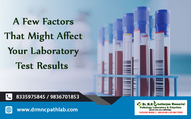 A Few Factors That Might Affect Your Laboratory Test Results