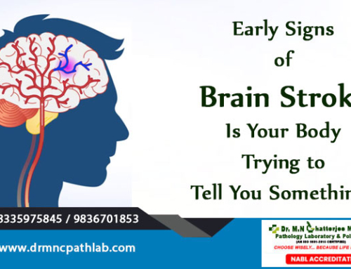 Early Signs of Brain Stroke- Is Your Body Trying to Tell You Something?