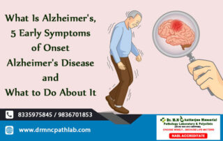 What Is Alzheimer's, 5 Early Symptoms of Onset Alzheimer's Disease and What to Do About It