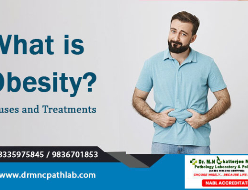 What is Obesity? Causes and Treatments
